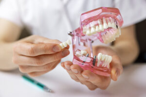 A dentist showing dental implant options on a jaw model